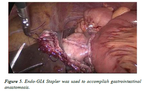 biomedres-Endo-GIA-Stapler