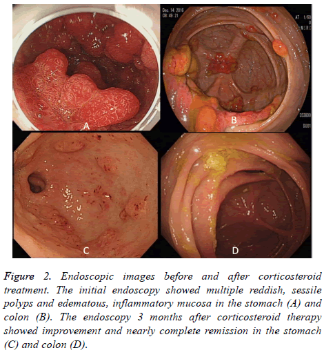 biomedres-Endoscopic-images