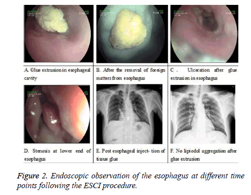 biomedres-Endoscopic-observation