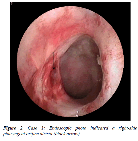 biomedres-Endoscopic-photo