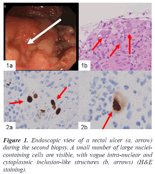 biomedres-Endoscopic-view