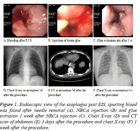 biomedres-Endoscopic-view