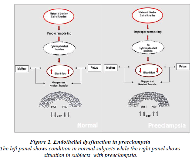 biomedres-Endothelial-dysfunction-preeclampsia