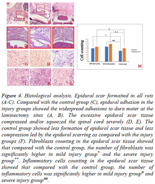 biomedres-Epidural-scar