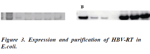 biomedres-Expression-purification-HBV-RT