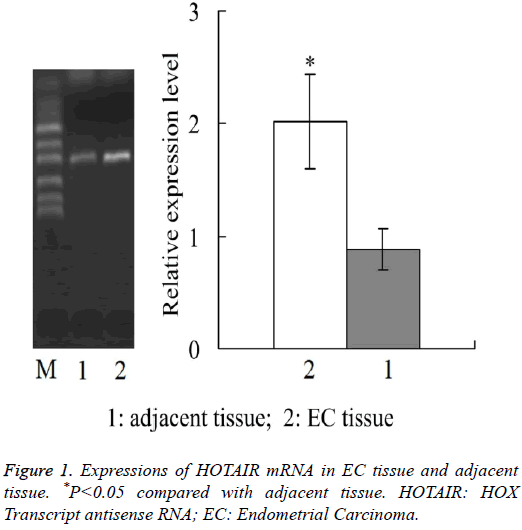 biomedres-Expressions-HOTAIR