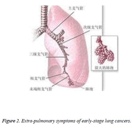 biomedres-Extra-pulmonary