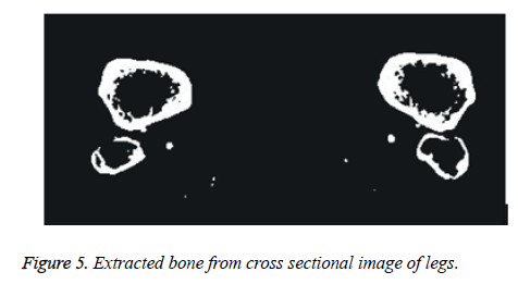 biomedres-Extracted-bone