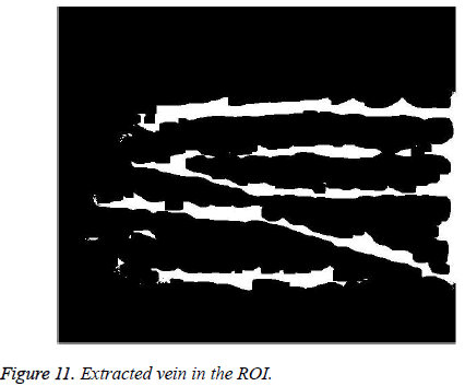 biomedres-Extracted-vein