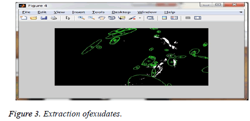 biomedres-Extraction-exudates