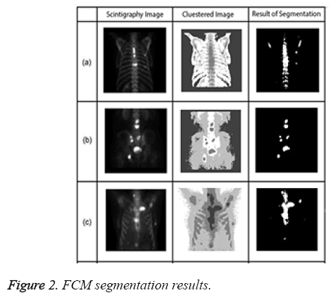 biomedres-FCM-segmentation-results