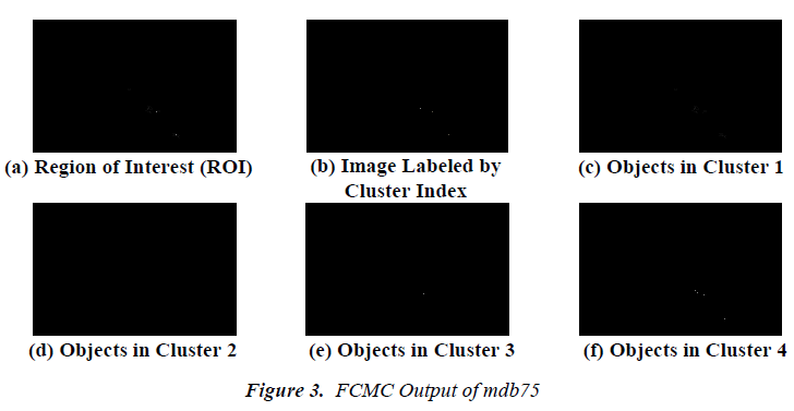 biomedres-FCMC-Output-mdb75