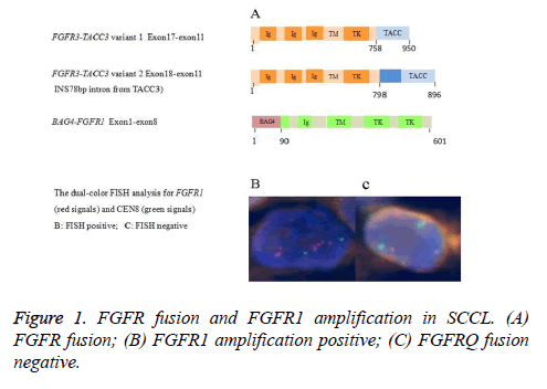 biomedres-FGFR-fusion