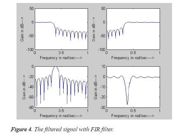 biomedres-FIR-filter