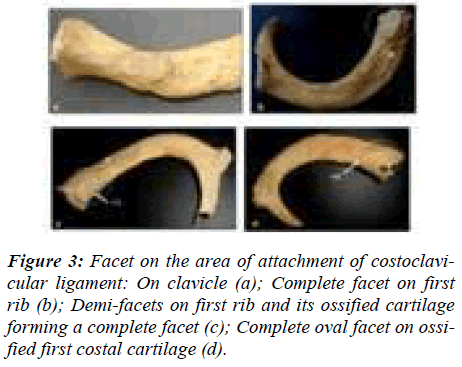 biomedres-Facet-area-attachment-ligament