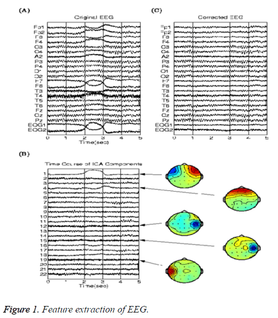 biomedres-Feature-extraction-EEG