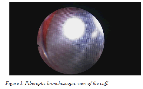 biomedres-Fiberoptic-bronchoscopic