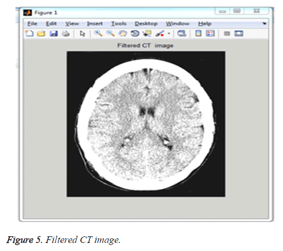 biomedres-Filtered-CT-image