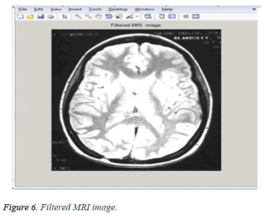 biomedres-Filtered-MRI-image