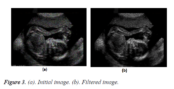 biomedres-Filtered-image