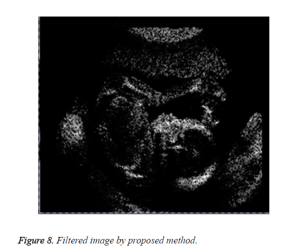 biomedres-Filtered-image-proposed-method