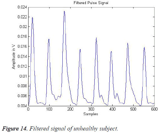 biomedres-Filtered-signal-unhealthy