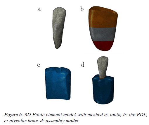 biomedres-Finite-element