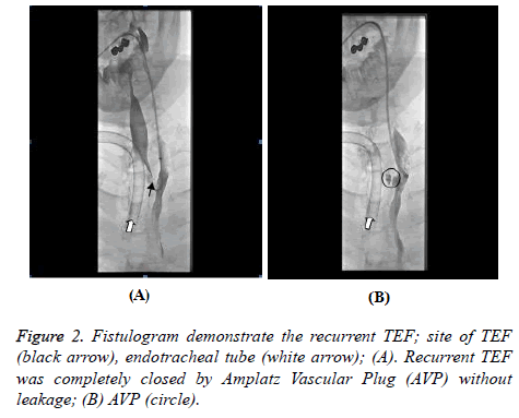 biomedres-Fistulogram-demonstrate