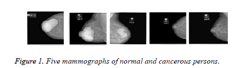 biomedres-Five-mammographs