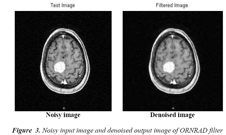 biomedres-Flow-graph-brain-tumor