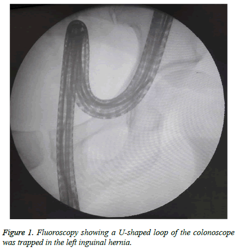 biomedres-Fluoroscopy