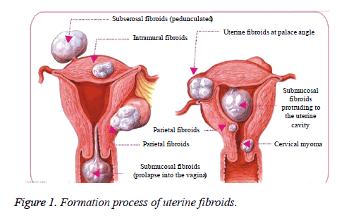 biomedres-Formation-process