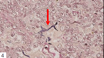 biomedres-Fragmented-elastic-fibers