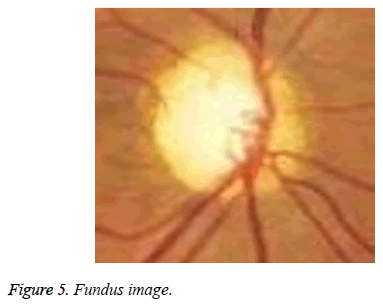 biomedres-Fundus-image