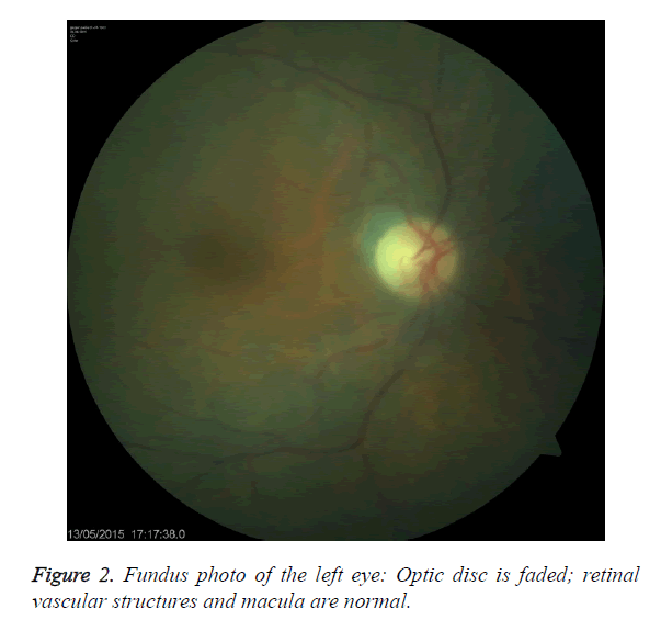 biomedres-Fundus-photo