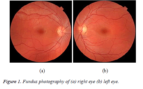 biomedres-Fundus-photography