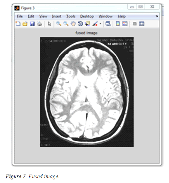 biomedres-Fused-image