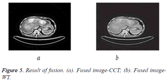 biomedres-Fused-image-CCT