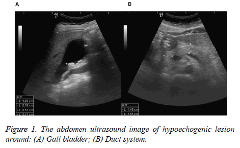 biomedres-Gall-bladder