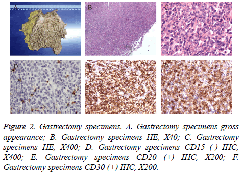 biomedres-Gastrectomy-specimens