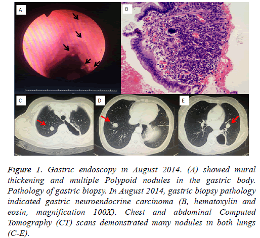 biomedres-Gastric-endoscopy