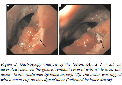 biomedres-Gastroscopy-gastric