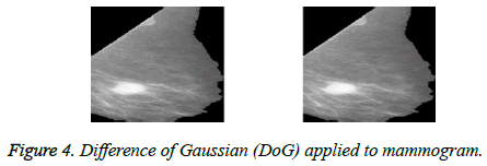 biomedres-Gaussian