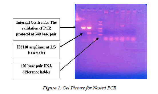 biomedres-Gel-Picture