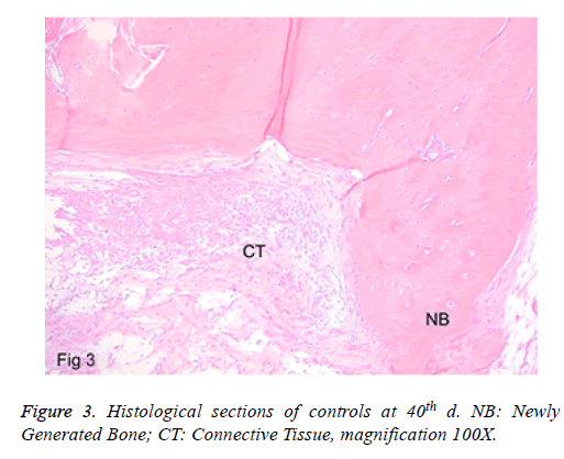 biomedres-Generated-Bone