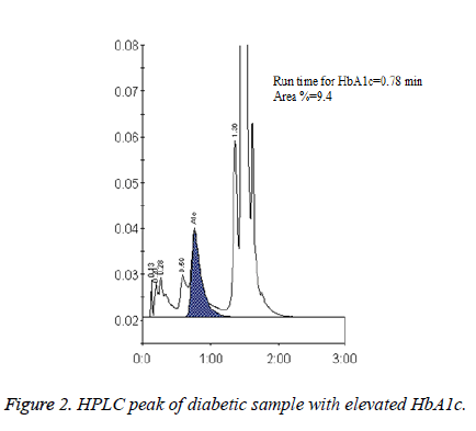 biomedres-HPLC-peak