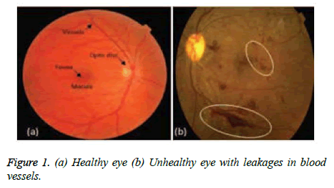 biomedres-Healthy-eye