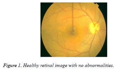 biomedres-Healthy-retinal-image