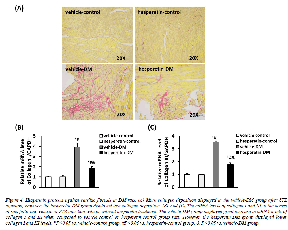 biomedres-Hesperetin-protects