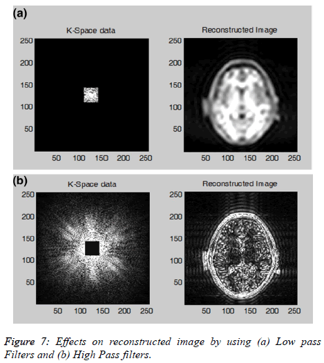 biomedres-High-Pass-filters